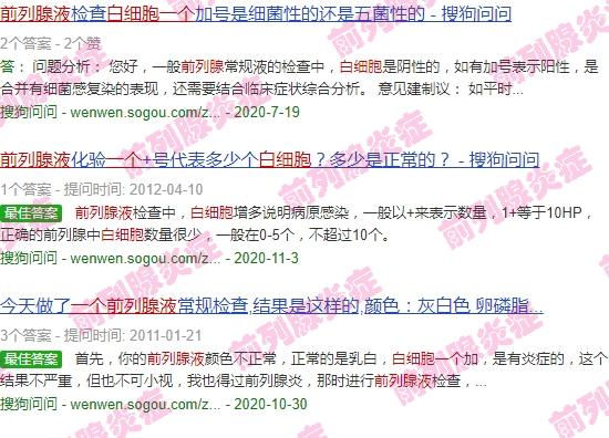 前列腺液白细胞一个加 - 汕头前列腺液白细胞1个加