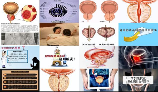前列腺没有炎症了为什么还疼 - 汕头前列腺没有炎症为什么还会勃起一下*软