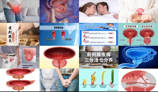 男前列腺炎同房对女性有伤害吗？- 汕头前列腺炎男生做爱多是不是不好