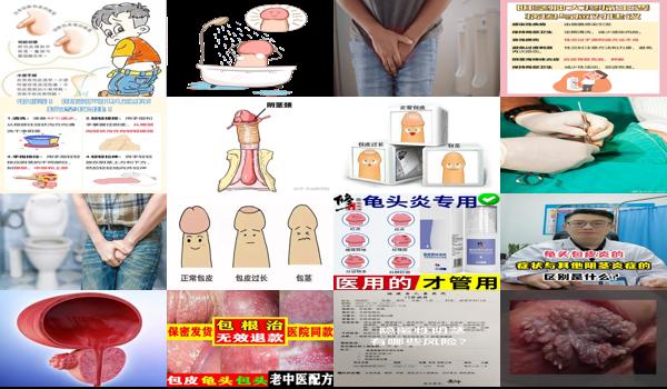 汕头有男性男科医院吗 - 汕头阴茎长期炎症会有什么后果