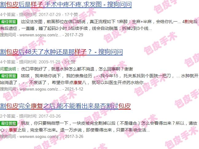 汕头*好的割包皮医院是哪家 - 汕头包皮割完恢复健康样子图片