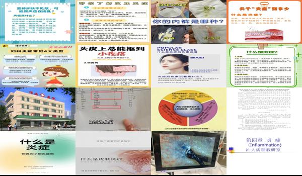 汕头肺炎确诊病例在哪治疗 - 汕头炎症是什么