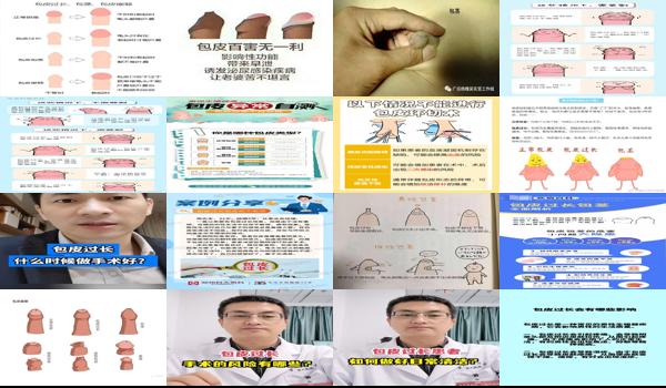 汕头割包皮需要多少钱 - 汕头包皮过长*要切吗