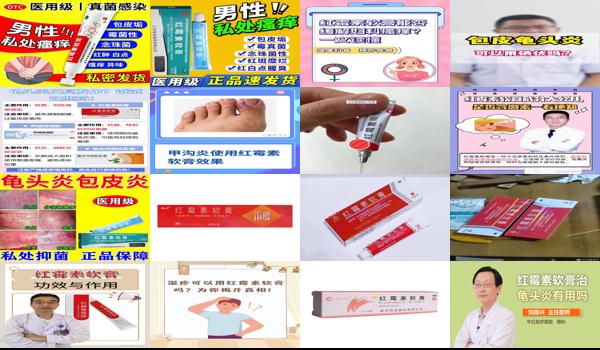 是不是*红霉素软膏都可以治龟 - 汕头红霉素软膏可以治疗龟头炎症吗